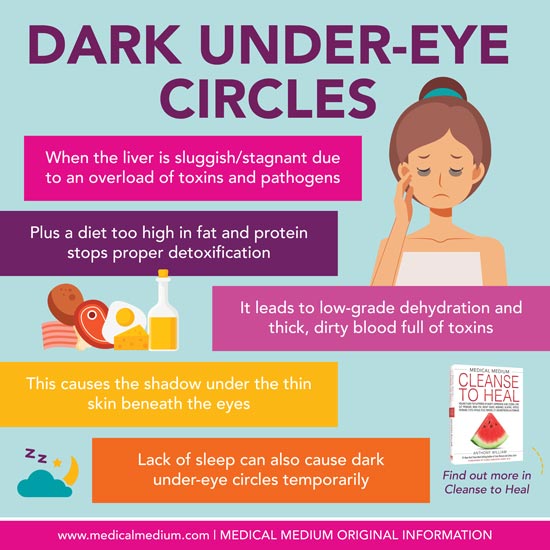 Dark Under-Eye Circles