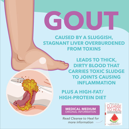 Gout