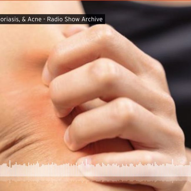 Healing Eczema, Psoriasis, & Acne