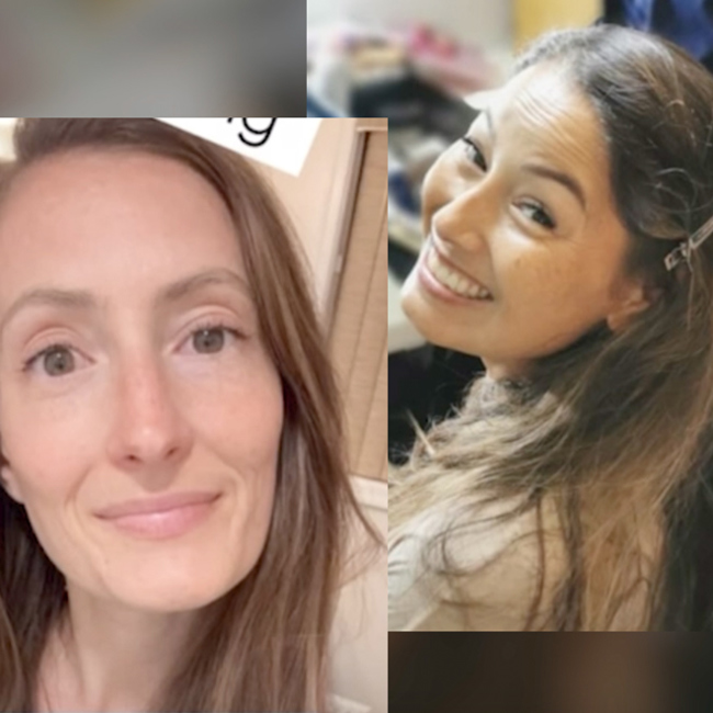 Eczema & Face Swelling Healed