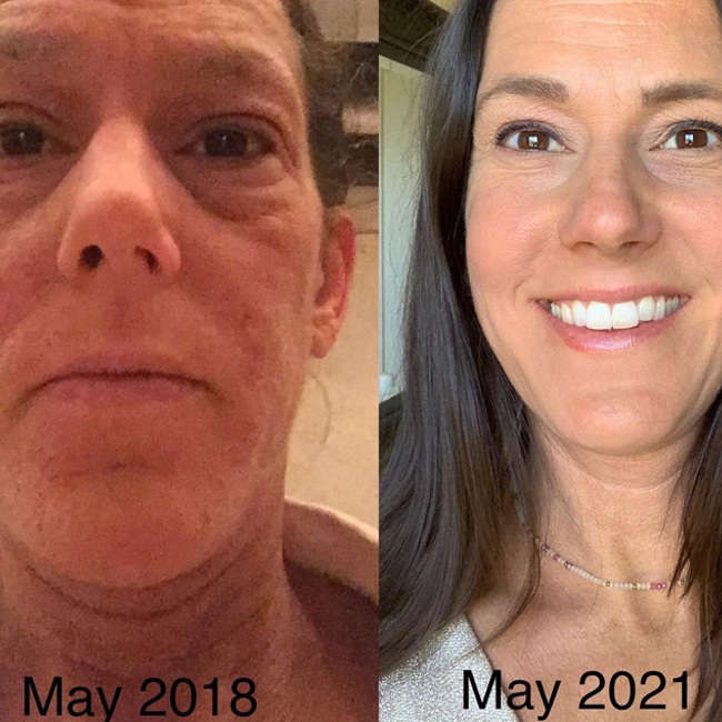 I Feel So Nourished, Hydrated & Light