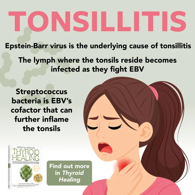 Tonsillitis